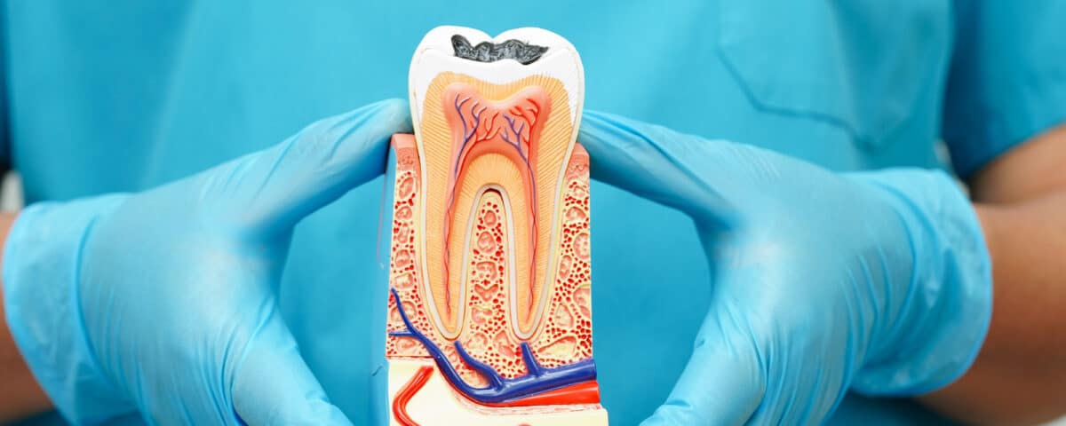 root-canal-therapy-saving-your-natural-tooth-and-relieving-pain